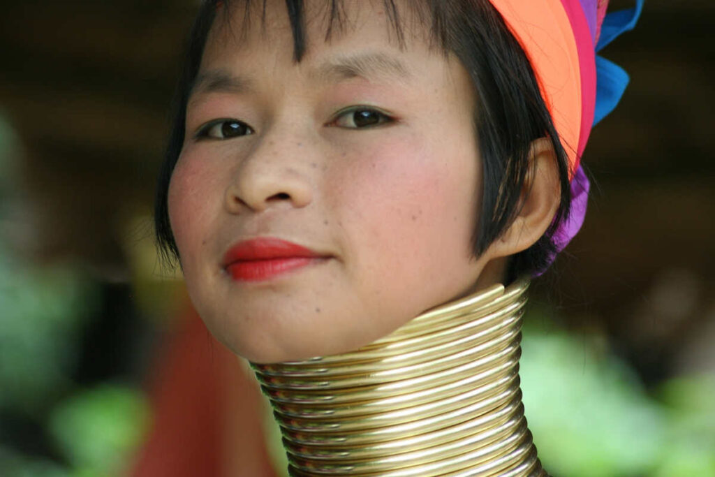 photo caption